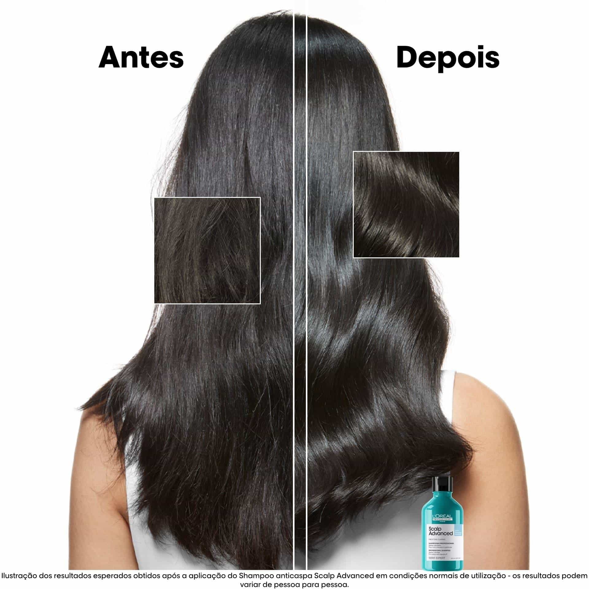 Shampoo anticaspa Scalp Advanced 300ml