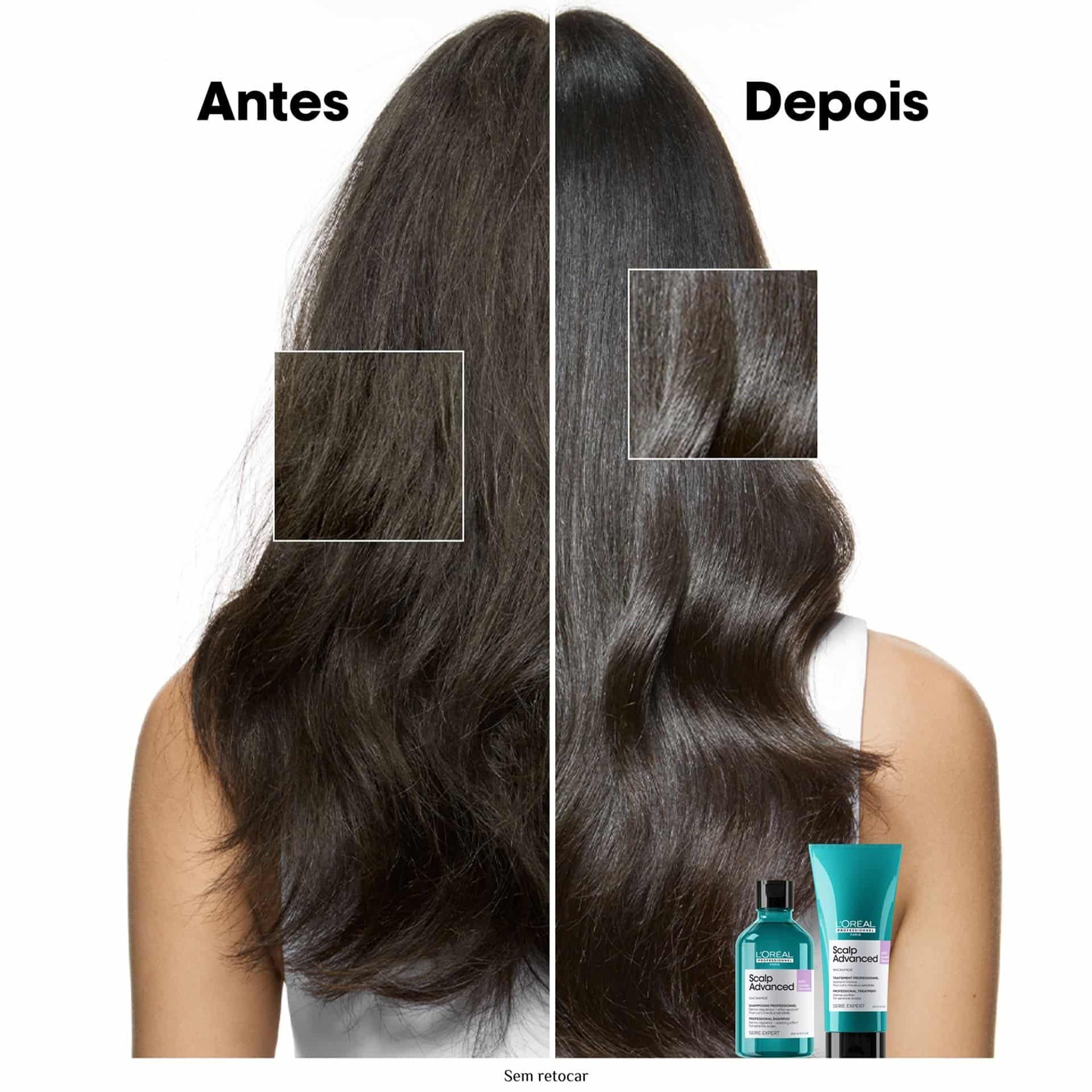 Shampoo Anti Desconforto Scalp Advanced 300ml 