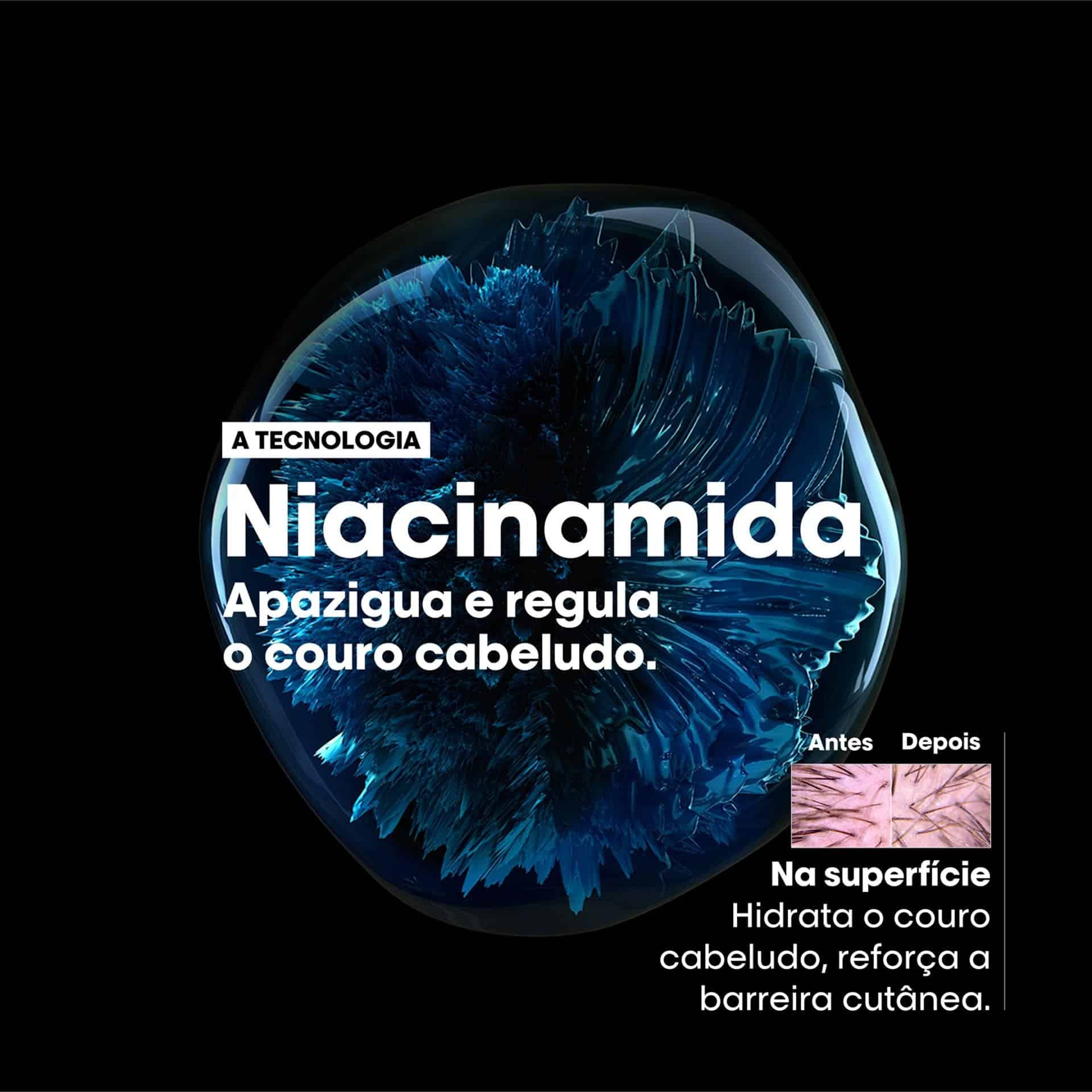 Shampoo Anti Desconforto Scalp Advanced 300ml 