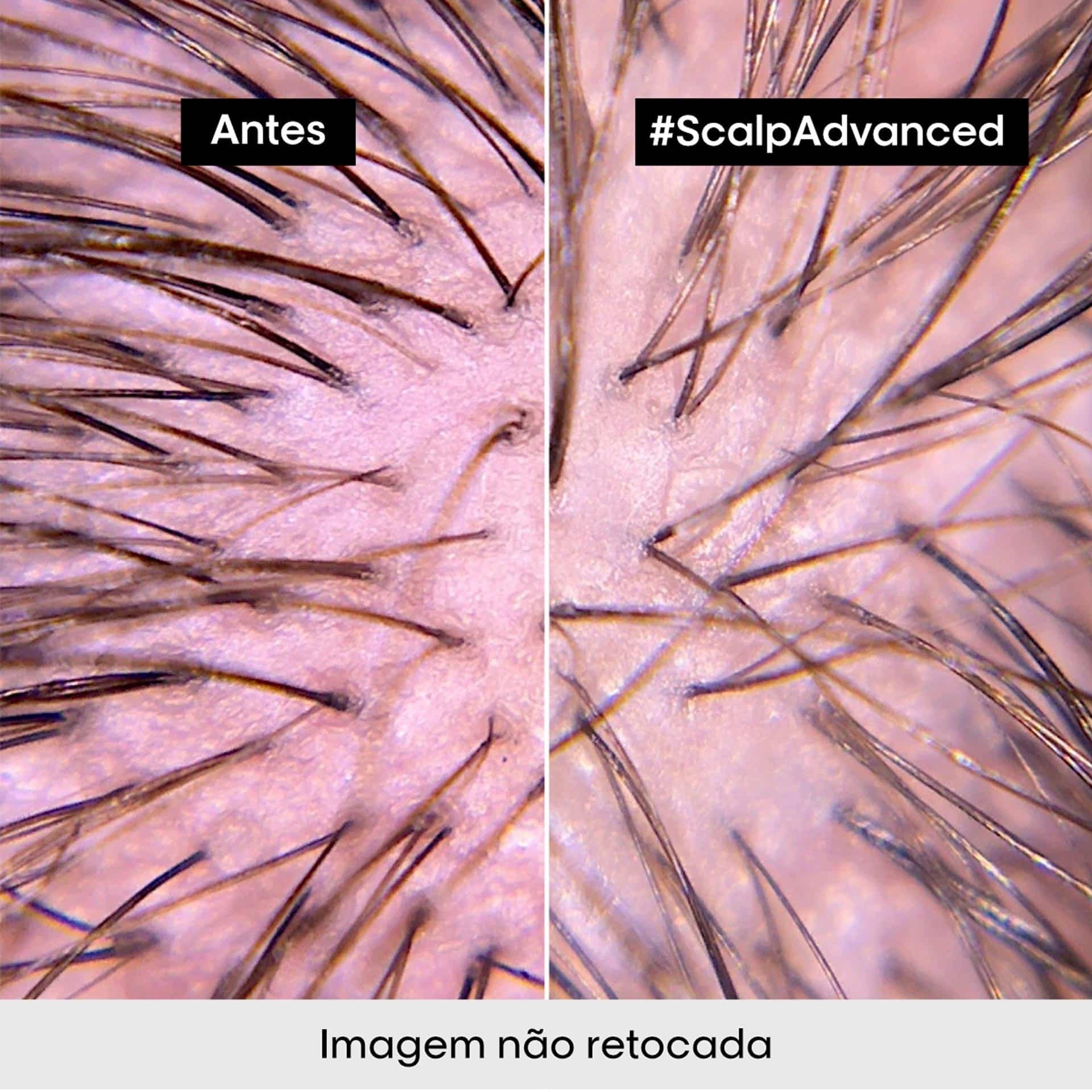 Tratamento anti-desconforto Scalp Advanced 200ml