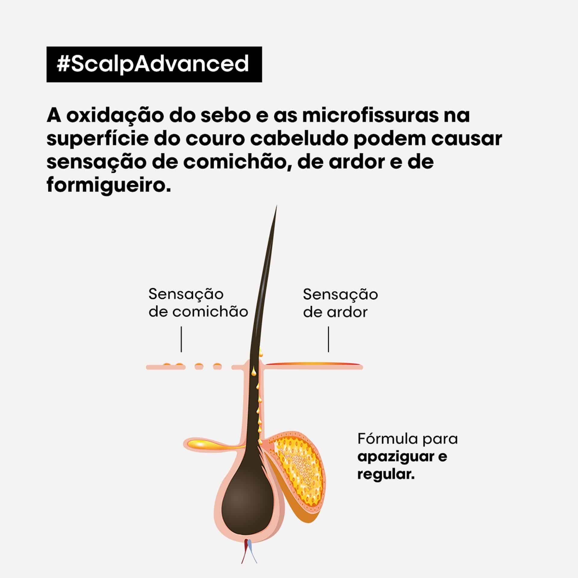 Tratamento anti-desconforto Scalp Advanced 200ml