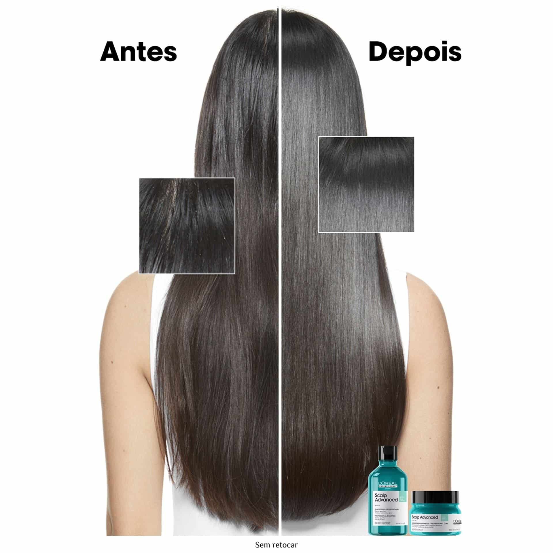 Argila Purificante 2 em 1 Scalp Advanced 250ml