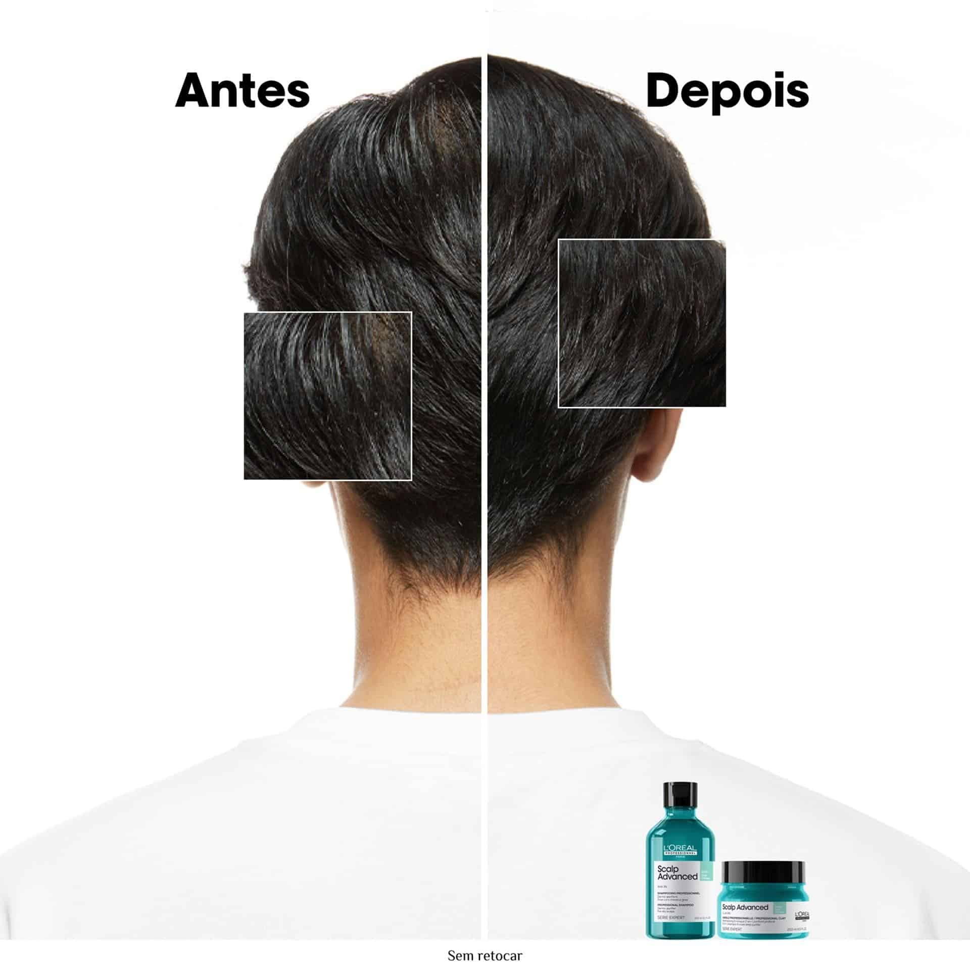 Argila Purificante 2 em 1 Scalp Advanced 250ml