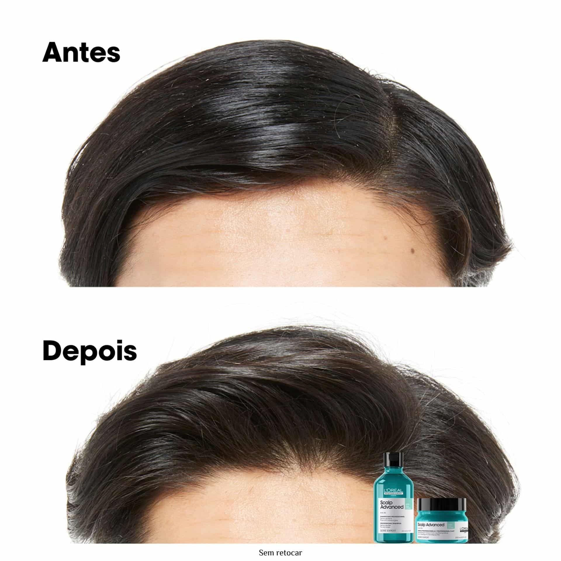 Argila Purificante 2 em 1 Scalp Advanced 250ml