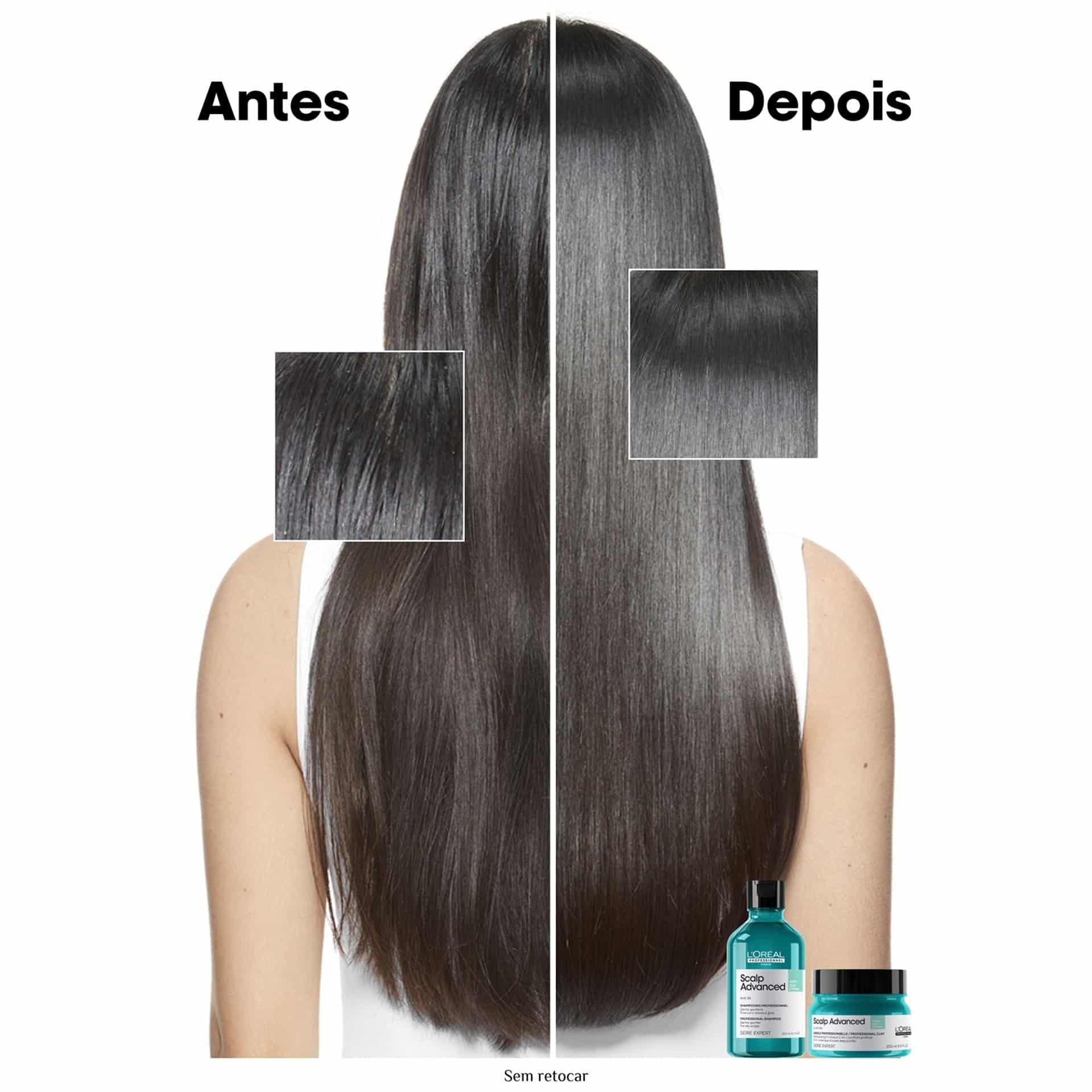 Shampoo Scalp Advanced Anti Oleosidade 300ml