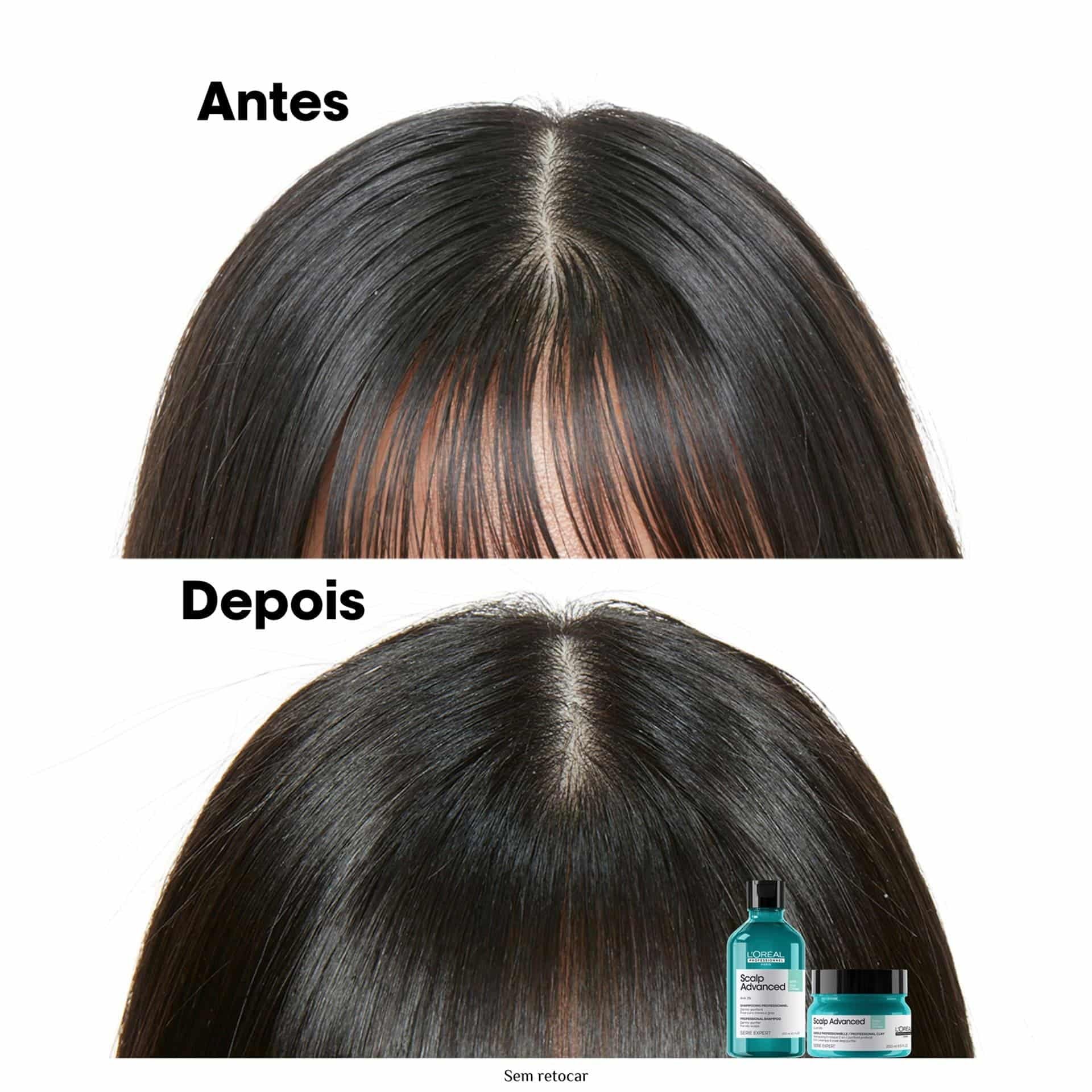 Shampoo Scalp Advanced Anti Oleosidade 300ml