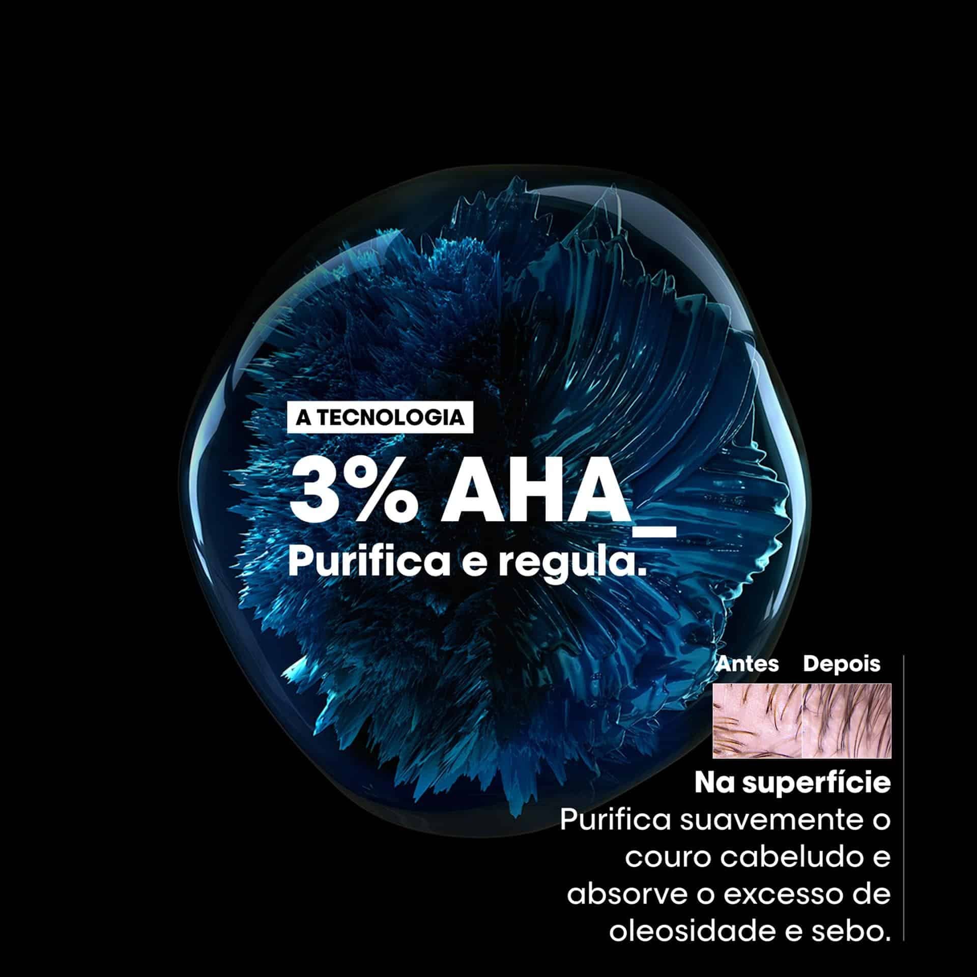 Shampoo Scalp Advanced Anti Oleosidade 300ml