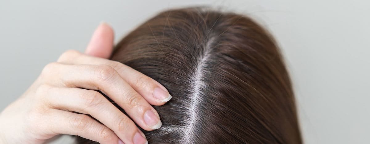 Imagem das raízes do cabelo de uma mulher.