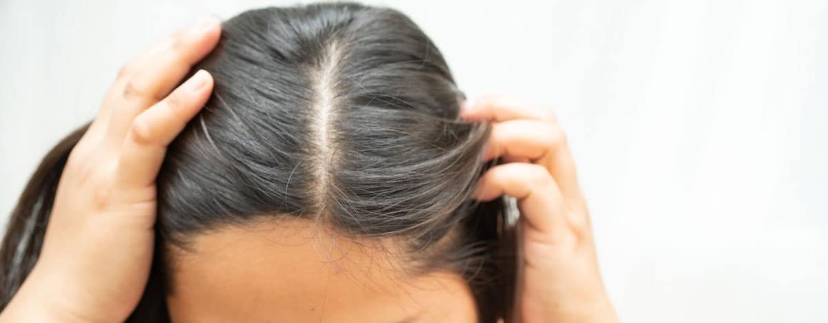 Imagem de raízes sensíveis no cabelo de uma mulher.