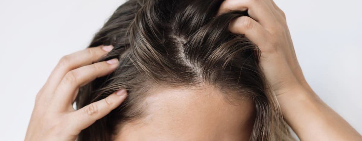 cabelo-misto