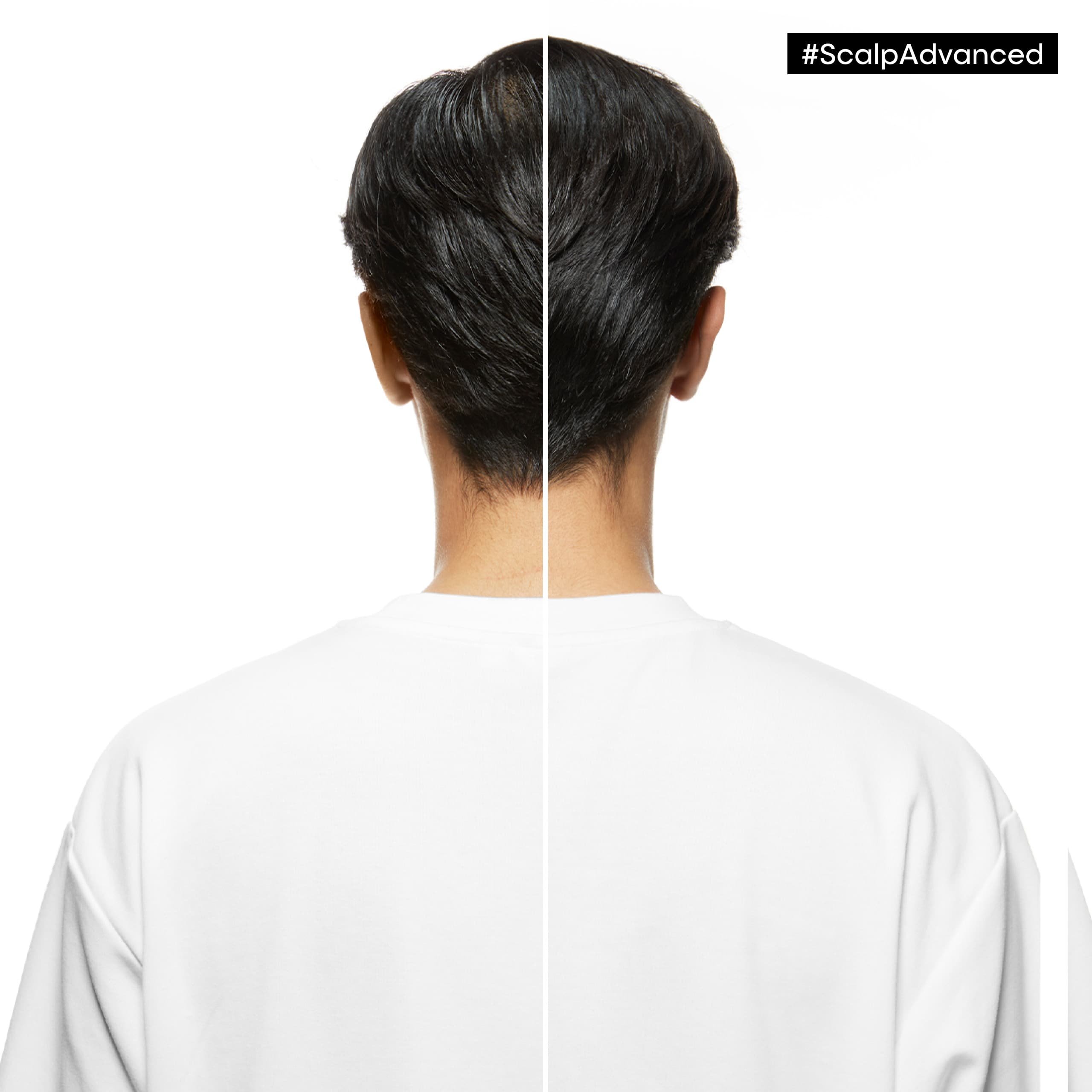 block-serie-expert-refills-2025-06-before-after-5